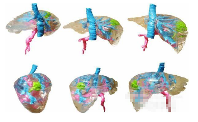 波蘭創(chuàng)建低成本彩色肝臟<a href=http://www.ttyulecheng168.com/dayin.html target=_blank class=infotextkey>3D打印模型</a>