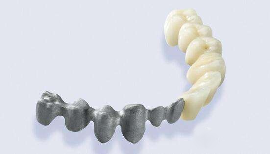 到2025年牙科3D打印市場預(yù)計(jì)實(shí)現(xiàn)最高增長